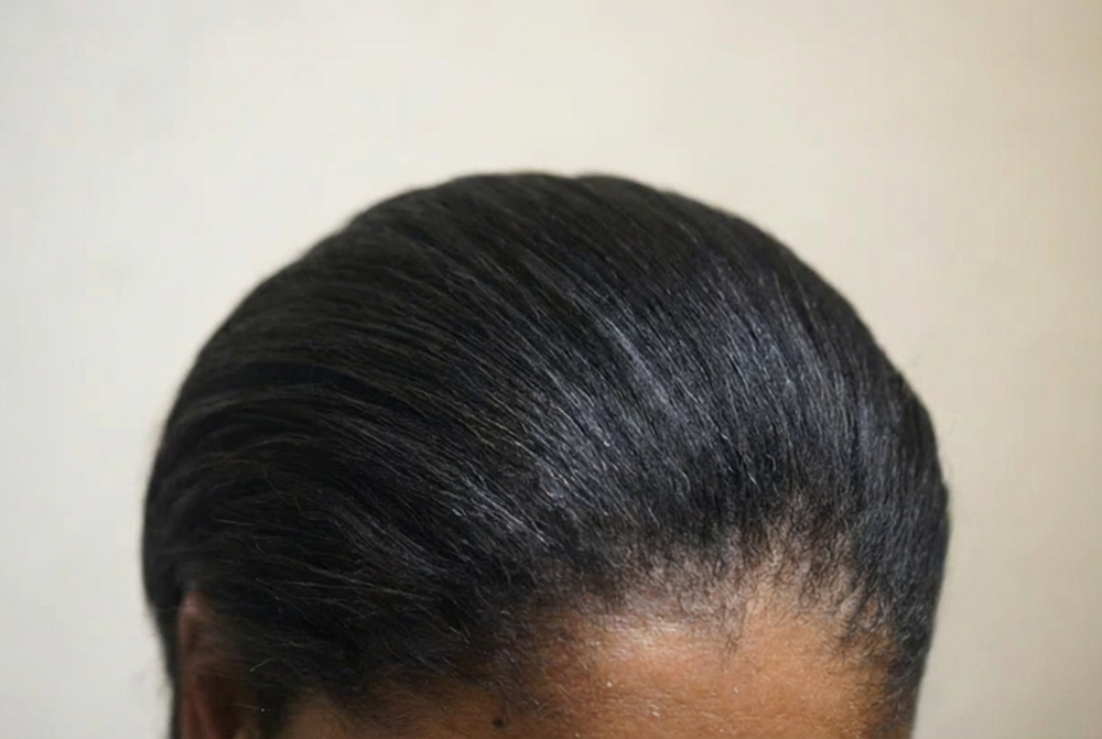Natasja, 45